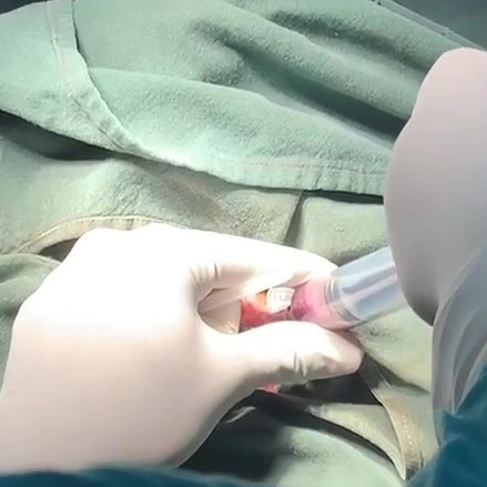 Aspiration picture crop