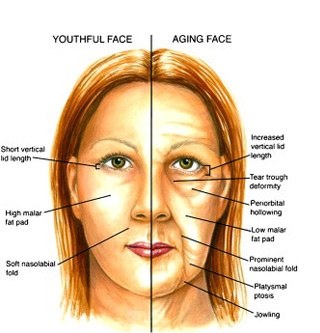 Blepharoplasty- Eyelid Lift&nbsp;Surgery